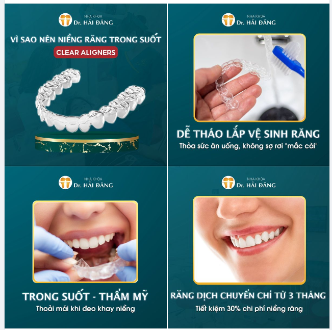 Niềng răng invisalign giải pháp tối ưu cho tình trạng răng hô, thưa, móm, khấp khểnh, khớp cắn phủ, khớp cắn ngược... 