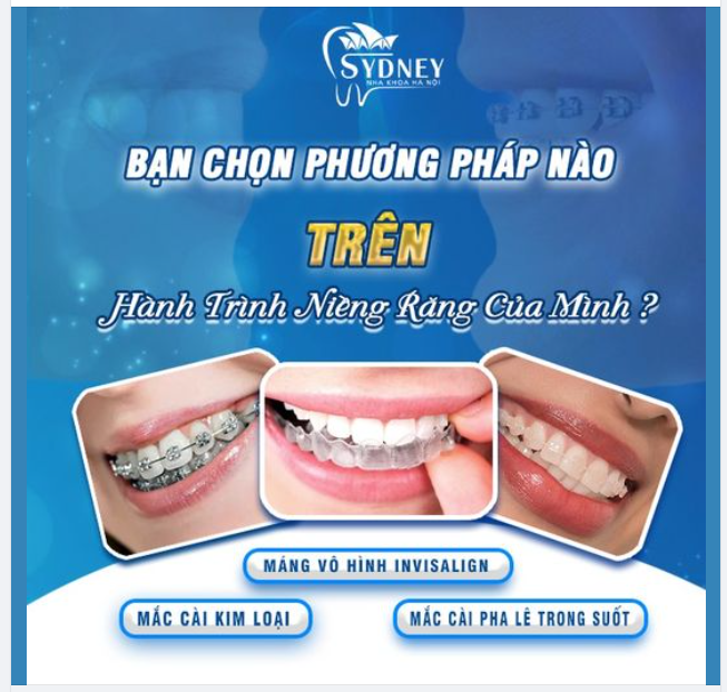 BẠN CHỌN PHƯƠNG PHÁP NÀO TRÊN HÀNH TRÌNH NIỀNG RĂNG CỦA MÌNH?