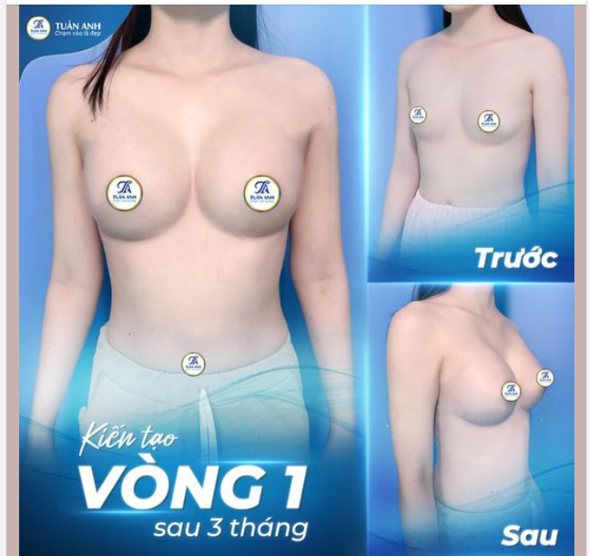 KẾT QUẢ NÂNG CẤP V1 SAU 3 THÁNG