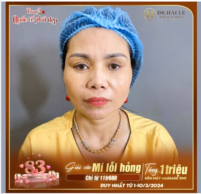 Chị em mí lỗi hỏng chú ý! Post này Dr.Hải Lê dành riêng cho chị em đó!