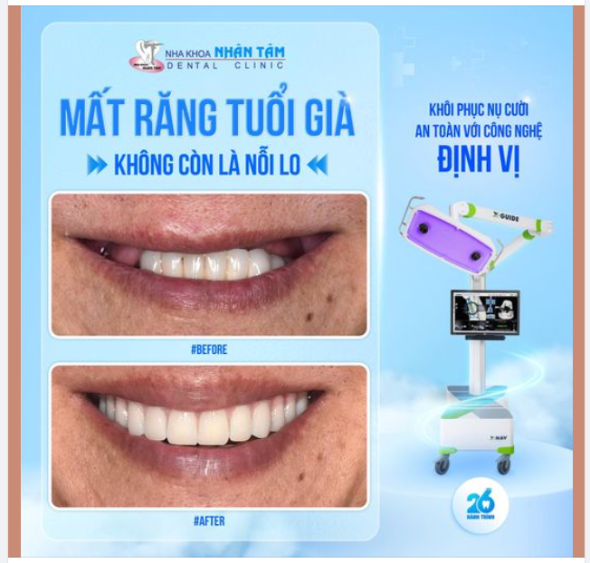 MẤT RĂNG TUỔI GIÀ KHÔNG CÒN LÀ NỖI LO