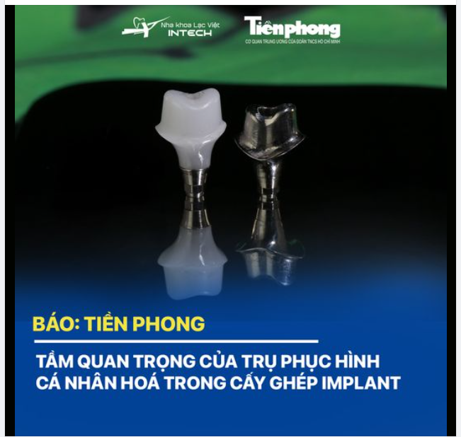 TẦM QUAN TRỌNG CỦA TRỤ PHỤC HÌNH CÁ NHÂN HÓA TRONG CẤY GHÉP IMPLANT