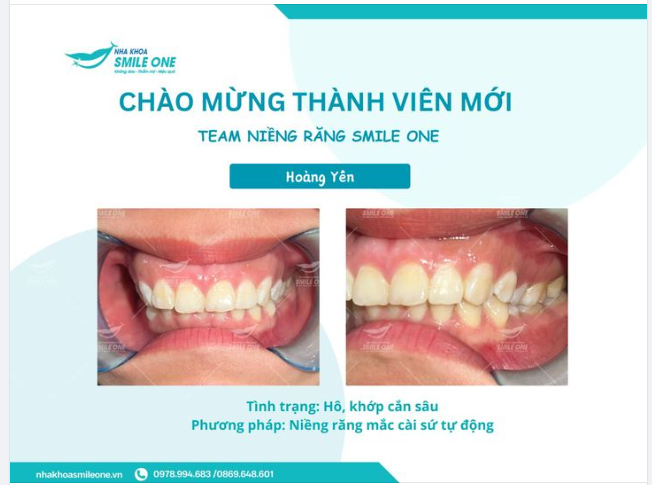 Chào mừng thành viên mới Team niềng răng Nha Khoa Smile One
