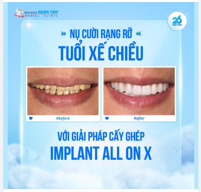 Nụ cười rạng rỡ tuổi xế chiều