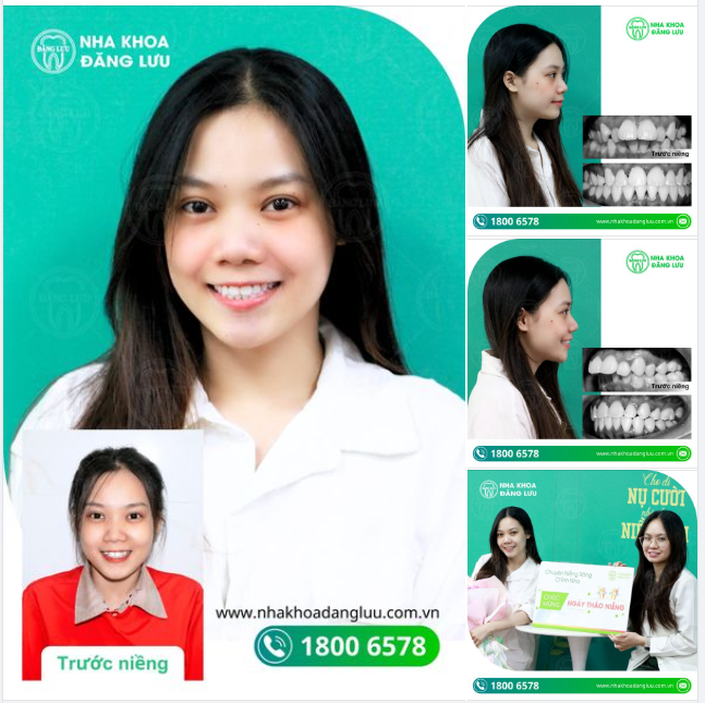 TỰ TIN NỞ NỤ CƯỜI XINH, BỪNG SÁNG CẢ GƯƠNG MẶT