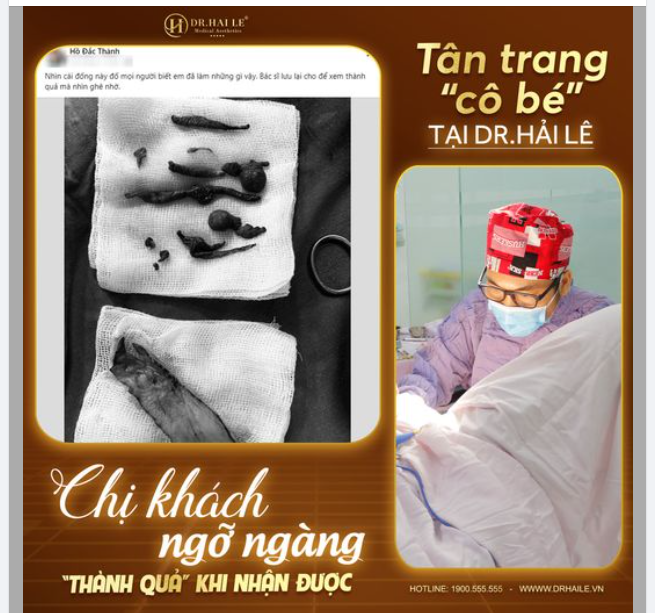 Chị khách sau khi tân trang “cô bé” tại Dr.Hải Lê chia sẻ.