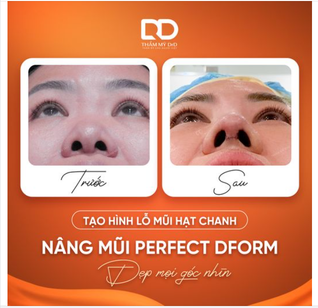 60 phút Từ LỖ MŨI BÈ NGANG sang LỖ MŨI HẠT CHANH XINH XẮN