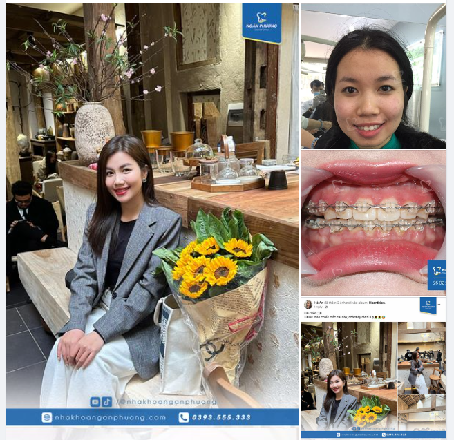 Từ chối quá khứ ngay sau khi tháo mắc cài