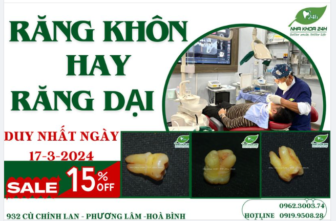 RĂNG KHÔN MỌC NHƯ NÀO THÌ CẦN NHỔ GẤP?