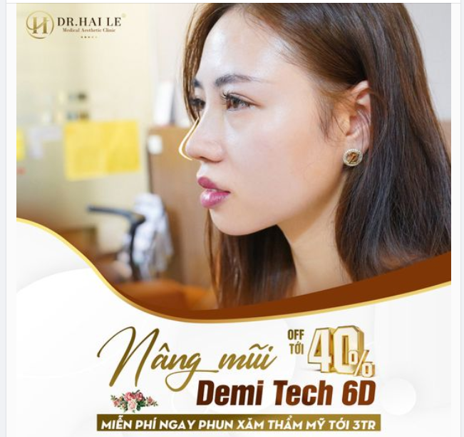 Bạn muốn sở hữu dáng mũi Demi Tech 6D đẹp hoàn hảo bất chấp thời gian mà đang lo lắng về chi phí?