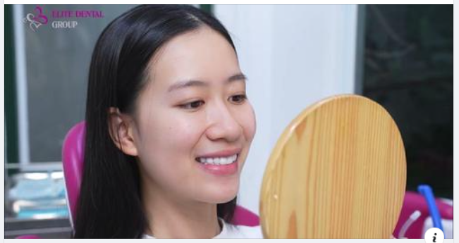 LÀM LẠI RĂNG SỨ SAU 4 NĂM VÀ CÁI KẾT!!!