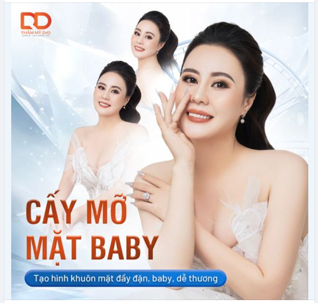 CẤY MỠ TỰ THÂN - TẠO HÌNH KHUÔN MẶT ĐẦY ĐẶN, BABY, DỄ THƯƠNG.