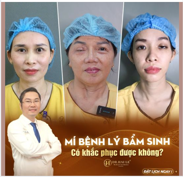 Mí bệnh lý bẩm sinh có khắc phục được không?