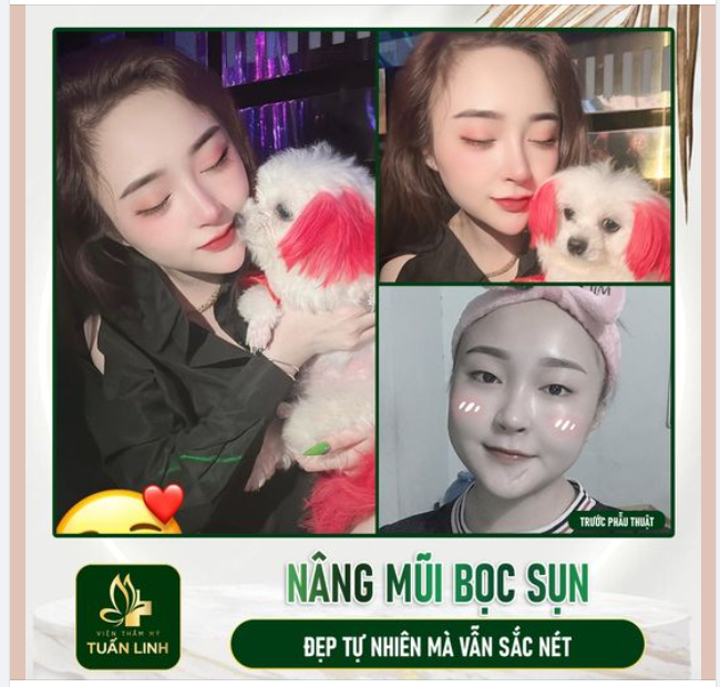 Chiếc mũi bọc sụn 15triệu Đẹp xứng đáng chưa ạ??