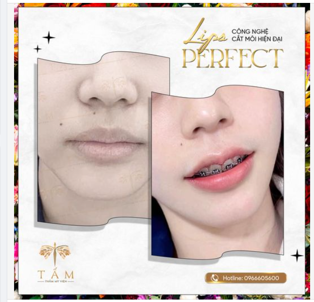 Nếu như đôi mắt được ví như cửa sổ tâm hồn thì đôi môi chính là nét duyên dáng, quyến rũ của mỗi người