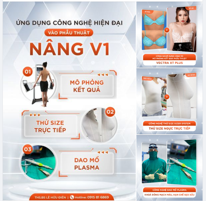 KHÁM PHÁ 3 CÔNG NGHỆ HIỆN ĐẠI TRONG PHẪU THUẬT NÂNG V1 TẠI DrD