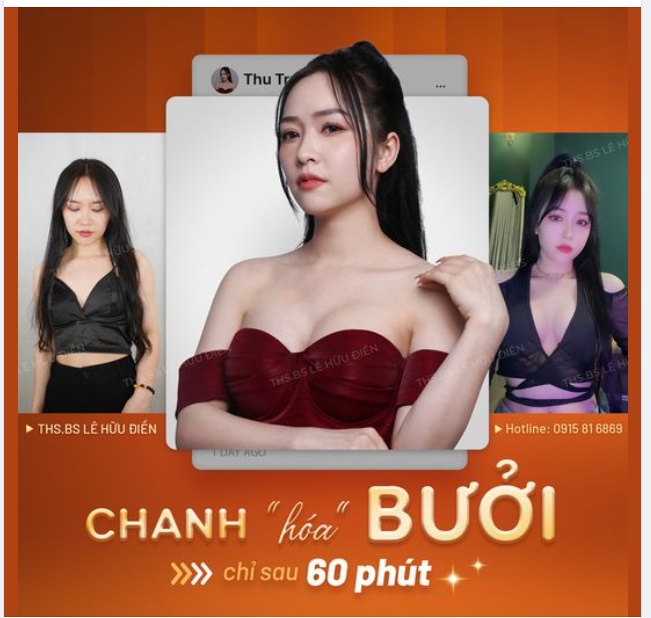 Yêu kiều và thật mĩ miều với Nâng ngực Harmonic. Thăng hạng sức hấp dẫn và cuốn hút