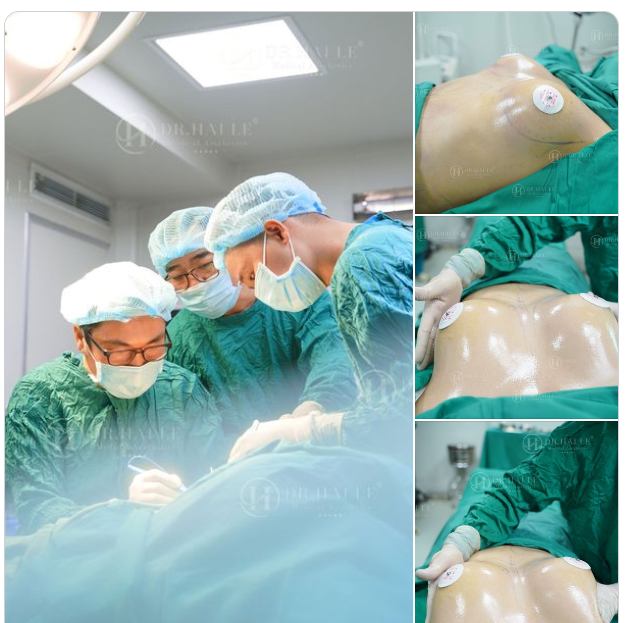 Nếu bạn đang sở hữu vòng 1 nhỏ, lép, chảy xệ thì đây là bài viết dành cho bạn.