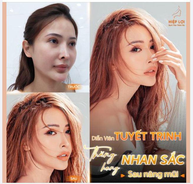 FLEX MŨI "NGOẠN MỤC" SAU 2 NĂM CỦA DIỄN VIÊN TUYẾT TRINH