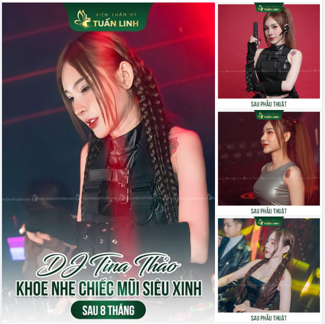 Nữ DJ Tina Thảo khoe nhẹ chiếc mũi siêu xinh của cô ấy sau 8 THÁNG sửa lại tại Tuấn Linh!!
