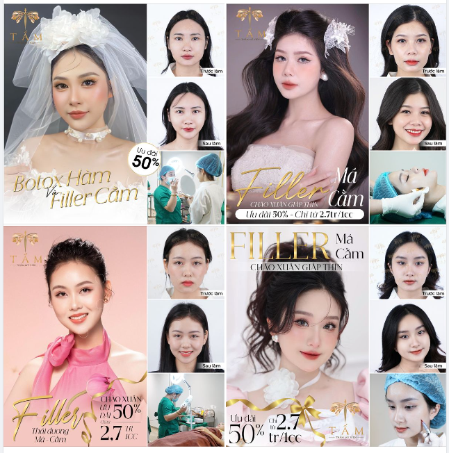 3 LÝ DO KHIẾN KHÁCH HÀNG "PHÁT CUỒNG" VỚI FILLER-BOTOX TMV TẤM