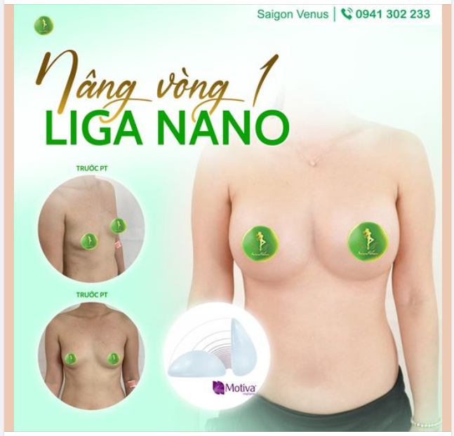 KHÁCH HÀNG NÓI GÌ VỀ DỊCH VỤ NÂNG V1 LIGA NANO TẠI SAIGON VENUS