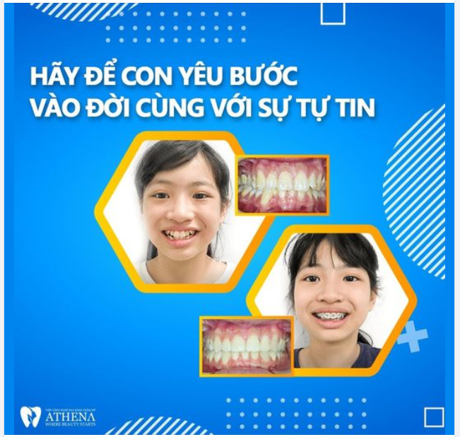 HÃY ĐỂ CON YÊU BƯỚC VÀO ĐỜI CÙNG VỚI SỰ TỰ TIN