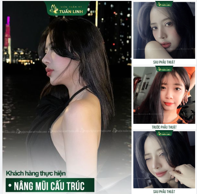 Dáng mũi cấu trúc đẹp sắc nét và cuốn hút quá khách ơi!