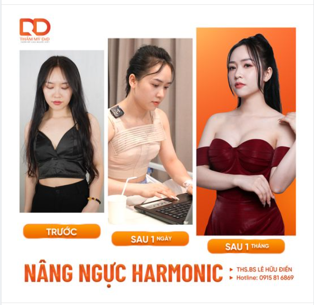 Cùng xem lại hành trình nâng ngực của cô nàng Thu Trúc