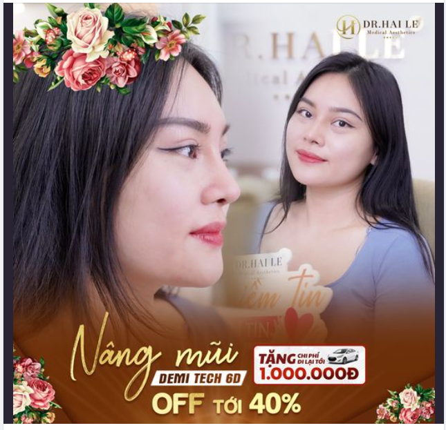 Nâng mũi Demi Tech 6D off tới 40% tặng ngay chi phí đi lại