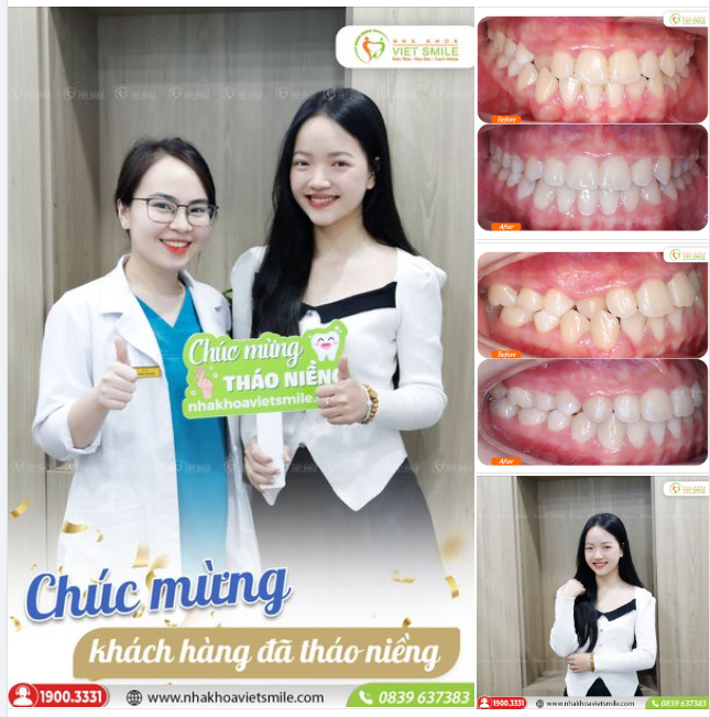 NỤ CƯỜI MỚI TỰ TIN, RẠNG RỠ HƠN