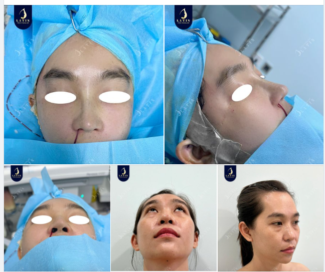 Thay đổi để xinh đẹp và tự tin hơn, bạn có muốn