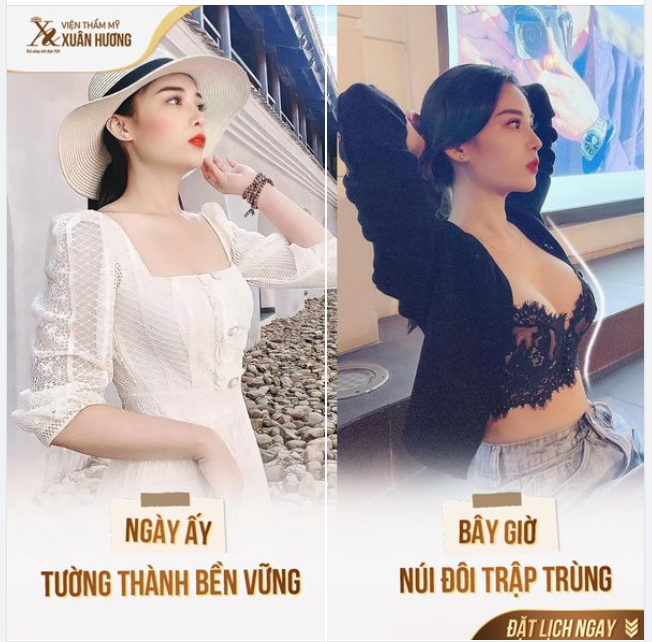 Thay lớp áo độn dày cộp bằng V1 đẫy đà tròn xinh