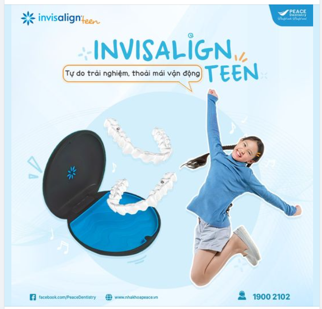 GIẢI PHÁP CHỈNH NHA DÀNH RIÊNG CHO TUỔI TEEN: HIỆU QUẢ CAO, DỄ CHỊU VÀ RẤT THẨM MỸ