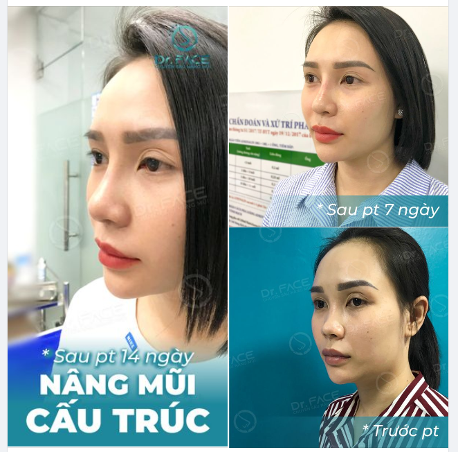 Không cần lúc nào cũng hiện diện. Nhưng đã xuất hiện là phải xinh…!