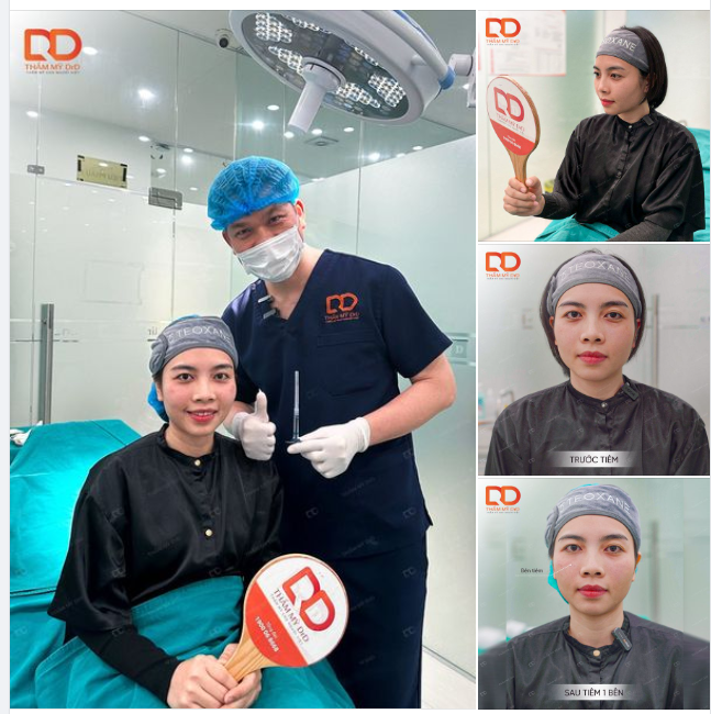 XOÁ QUẦNG THÂM, LÀM ĐẦY RÃNH MẮT CHỈ SAU 15 PHÚT THỰC HIỆN