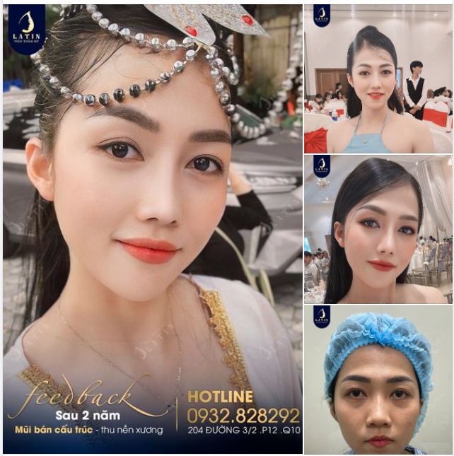 Tự tin là chính mình trong mọi hoàn cảnh. Feedback mũi bán cấu trúc 2 năm tuổi từ em gái xinh đẹp