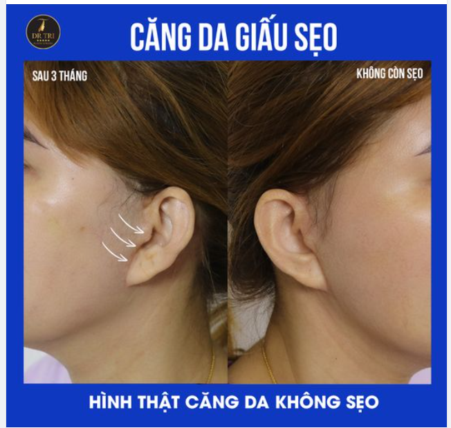 BỎ RA 3 THÁNG CHỜ ĐỢI LIỆU CÓ XỨNG ĐÁNG???