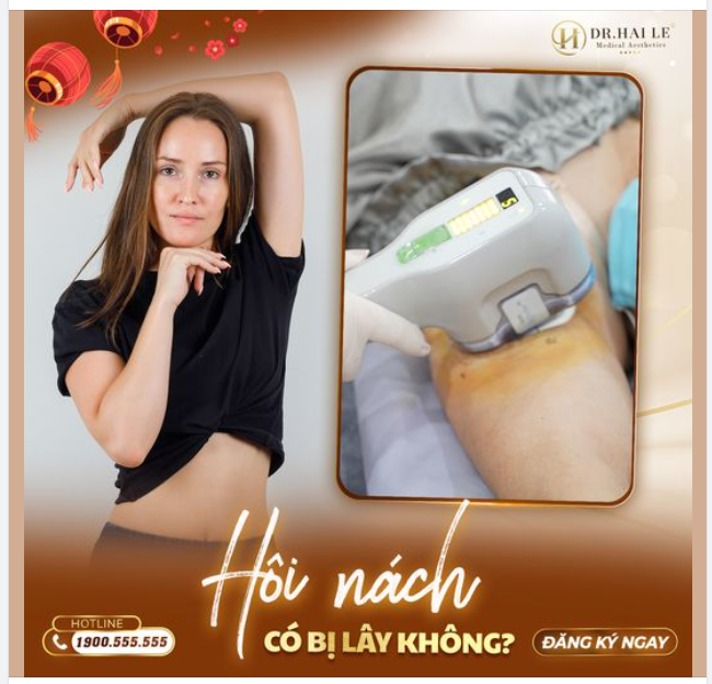 Hôi nách có bị lây không?