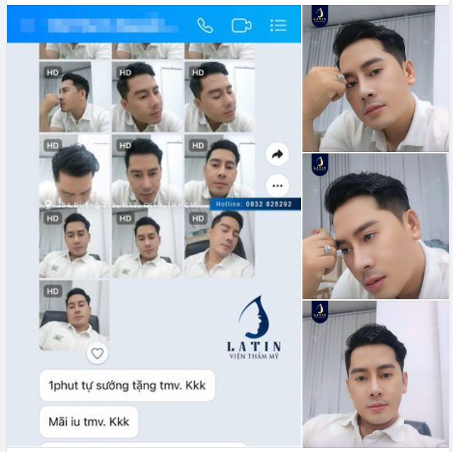 Hotboy nhà Latin. Sau 2 năm nâng mũi bán cấu trúc, cả cuộc đời và sự nghiệp của anh đều "nâng hương".