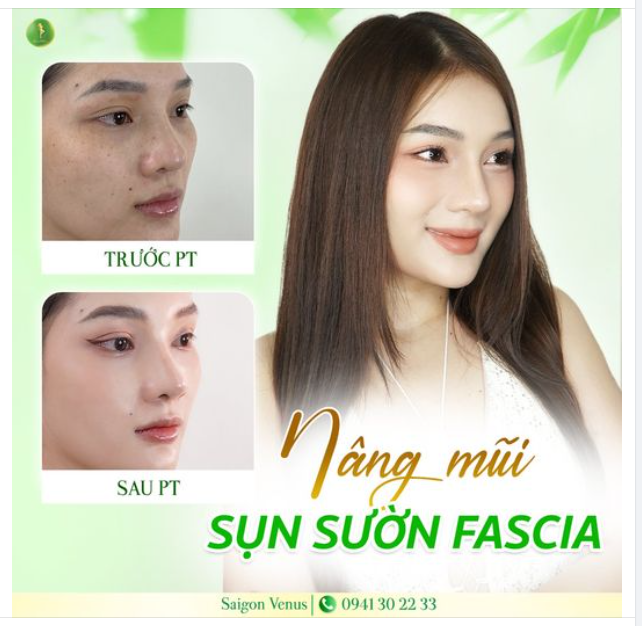 FEEDBACK DÁNG MŨI CHUẨN 100% CỦA SAIGON VENUS
