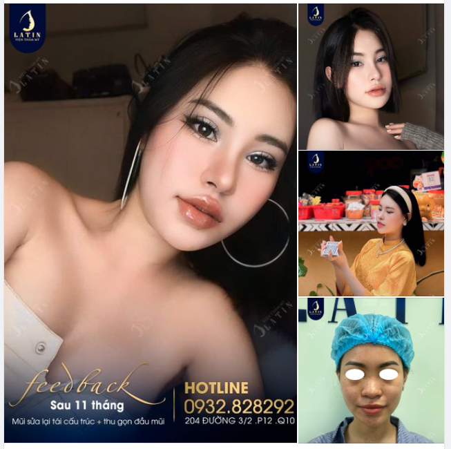 Đã xinh nay lại càng xinh hơn. Nhìn tự nhiên thế này đâu ai biết em đã nâng mũi đâu