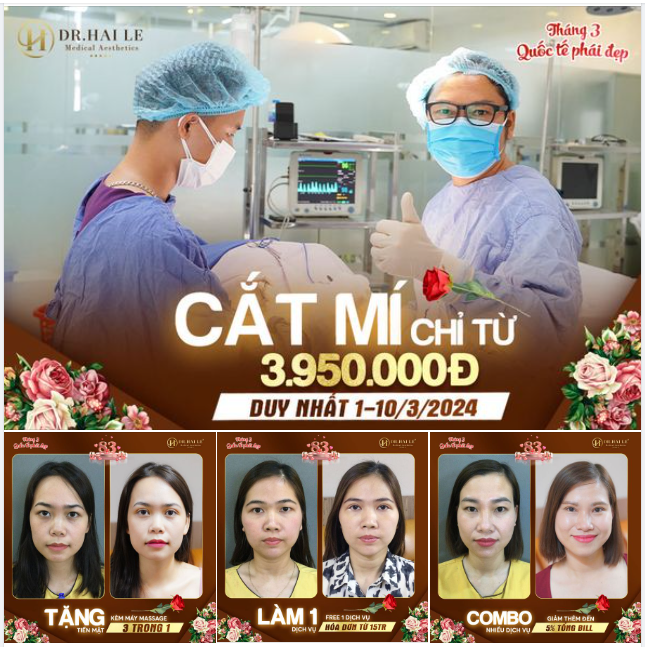 Tháng 3 này - Tháng tri ân phái đẹp, Dr.Hải Lê tặng chị em ưu đãi cắt mí siêu khủng nha