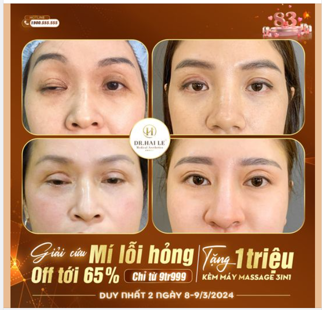 Kết quả chính xác theo dõi dưới bình luận