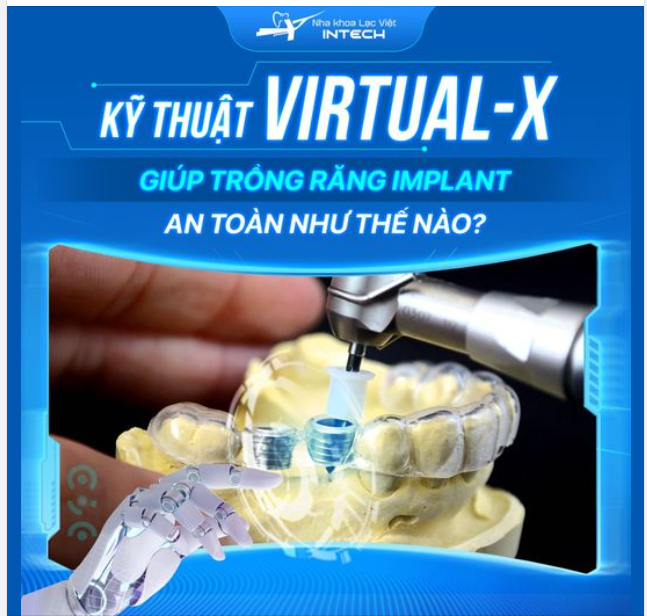 KỸ THUẬT VIRTUAL-X GIÚP QUÁ TRÌNH TRỒNG RĂNG IMPLANT AN TOÀN NHƯ THẾ NÀO?