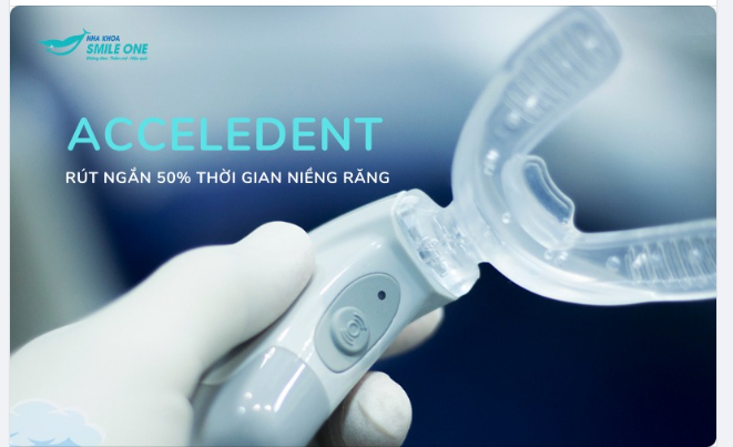Rút ngắn thời gian niềng răng lên tới 50% với thiết bị AcceleDent