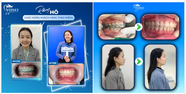 TRỌN VẸN YÊU THƯƠNG - NỤ CƯỜI RẠNG RỠ
