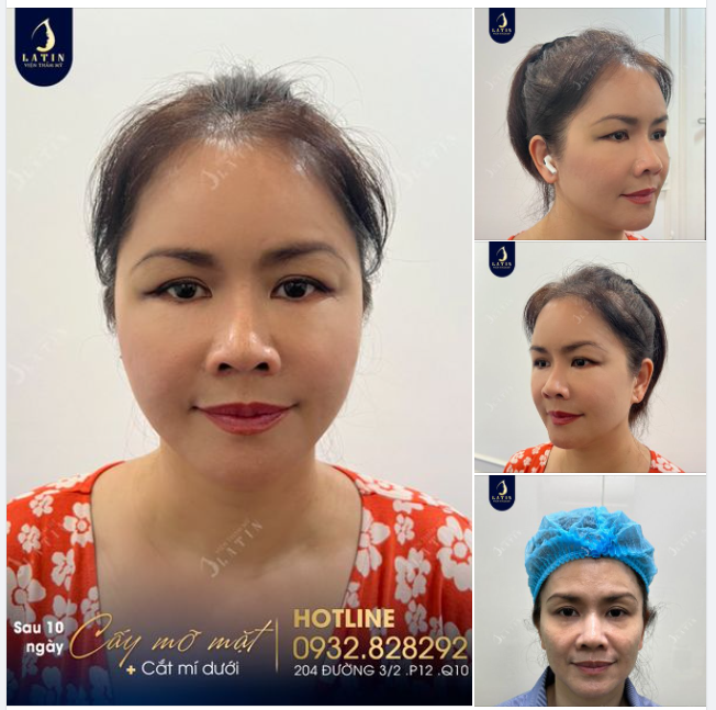 Ai nói thanh xuân đã qua thì không trở lại được...