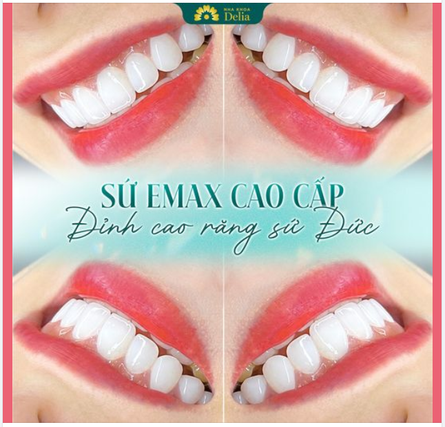 RĂNG SỨ EMAX ĐỈNH CAO CỦA SỰ HOÀN HẢO