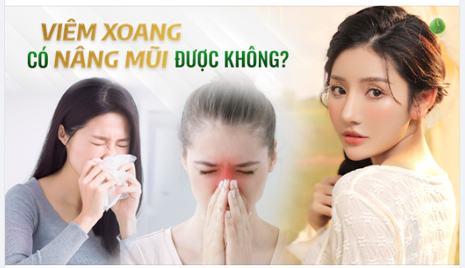 VIÊM XOANG CÓ NÂNG MŨI ĐƯỢC KHÔNG?